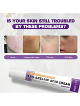 SHEIN Azelaic Acid Cream For Face Acne Cream