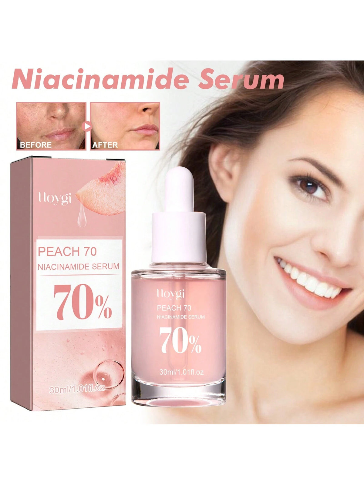 SHEIN Niacinamide Serum Dark Spot Correcting Moisturizing