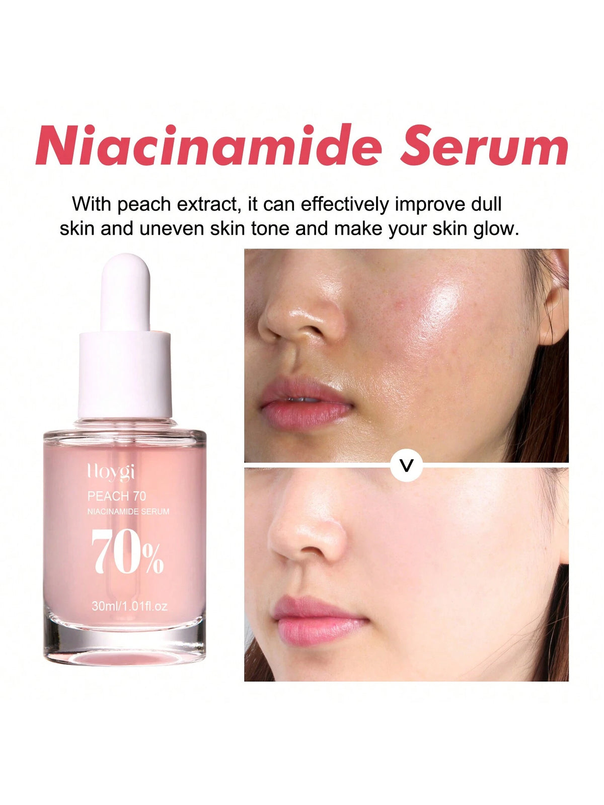 SHEIN Niacinamide Serum Dark Spot Correcting Moisturizing