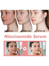 SHEIN Niacinamide Serum Dark Spot Correcting Moisturizing
