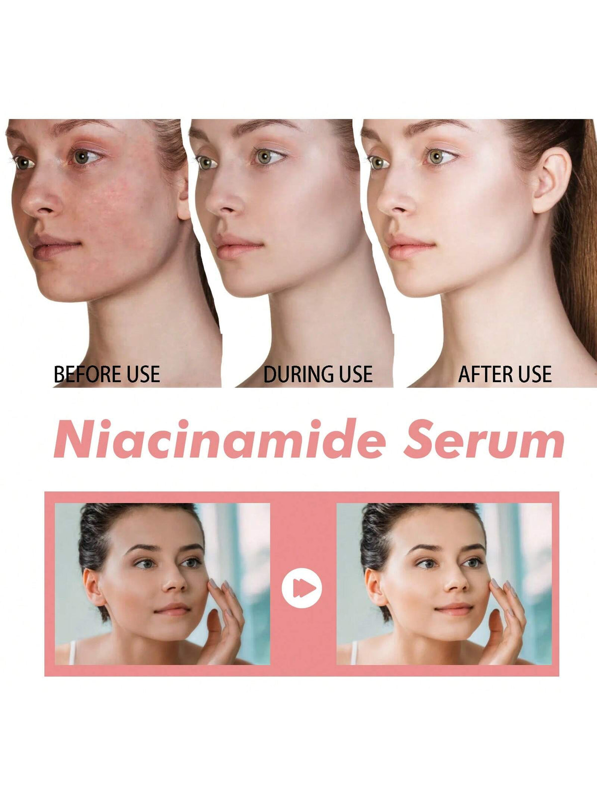 SHEIN Niacinamide Serum Dark Spot Correcting Moisturizing