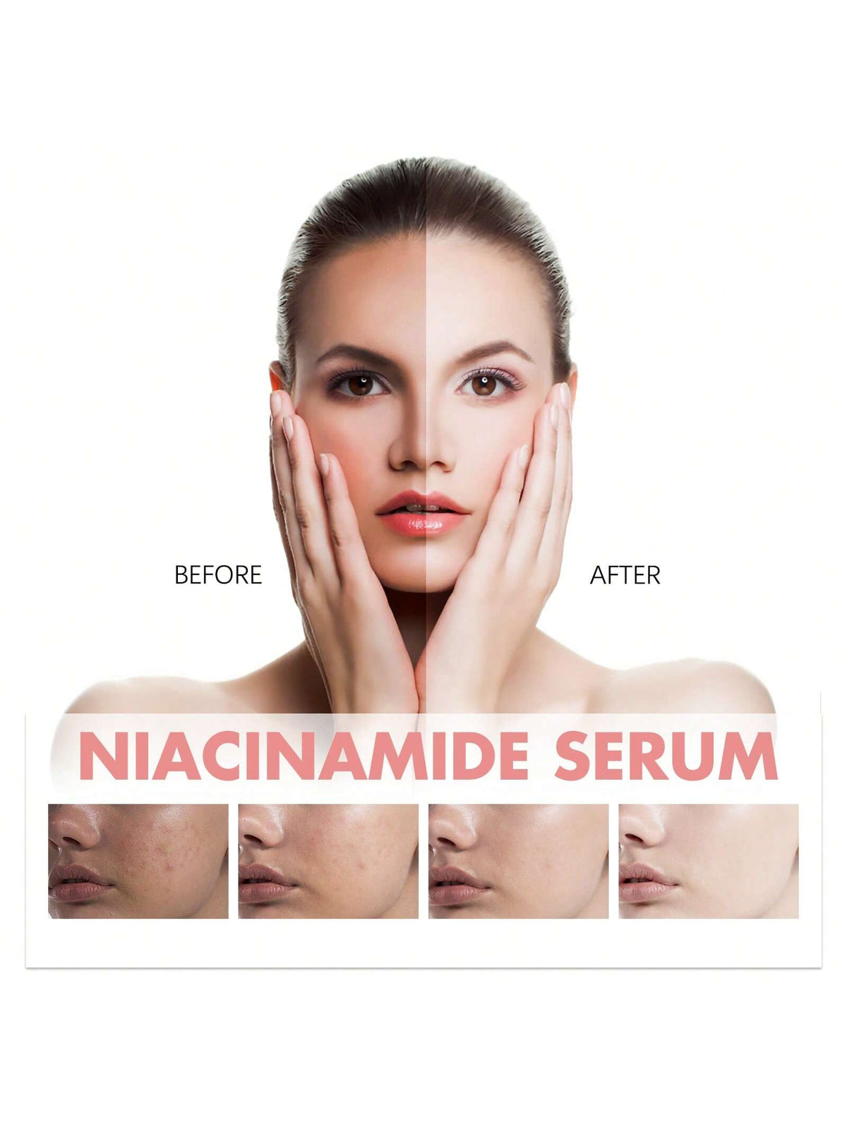 SHEIN Niacinamide Serum Dark Spot Correcting Moisturizing