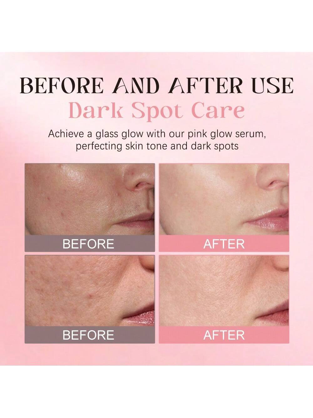 SHEIN KOEC Rose Pdrn Pink Peptide Serum, Dark Spot Care