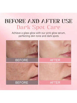 SHEIN KOEC Rose Pdrn Pink Peptide Serum, Dark Spot Care