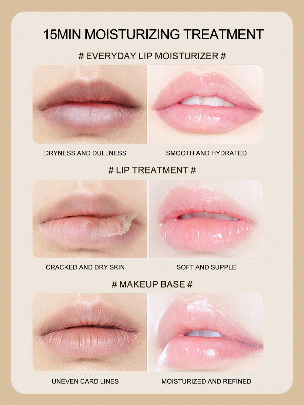 SHEIN Moisturizing And Nourishing Lip Mask