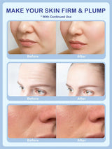 SHEIN SlowSunday Collagen & Hyaluronic Acid Facial Mask