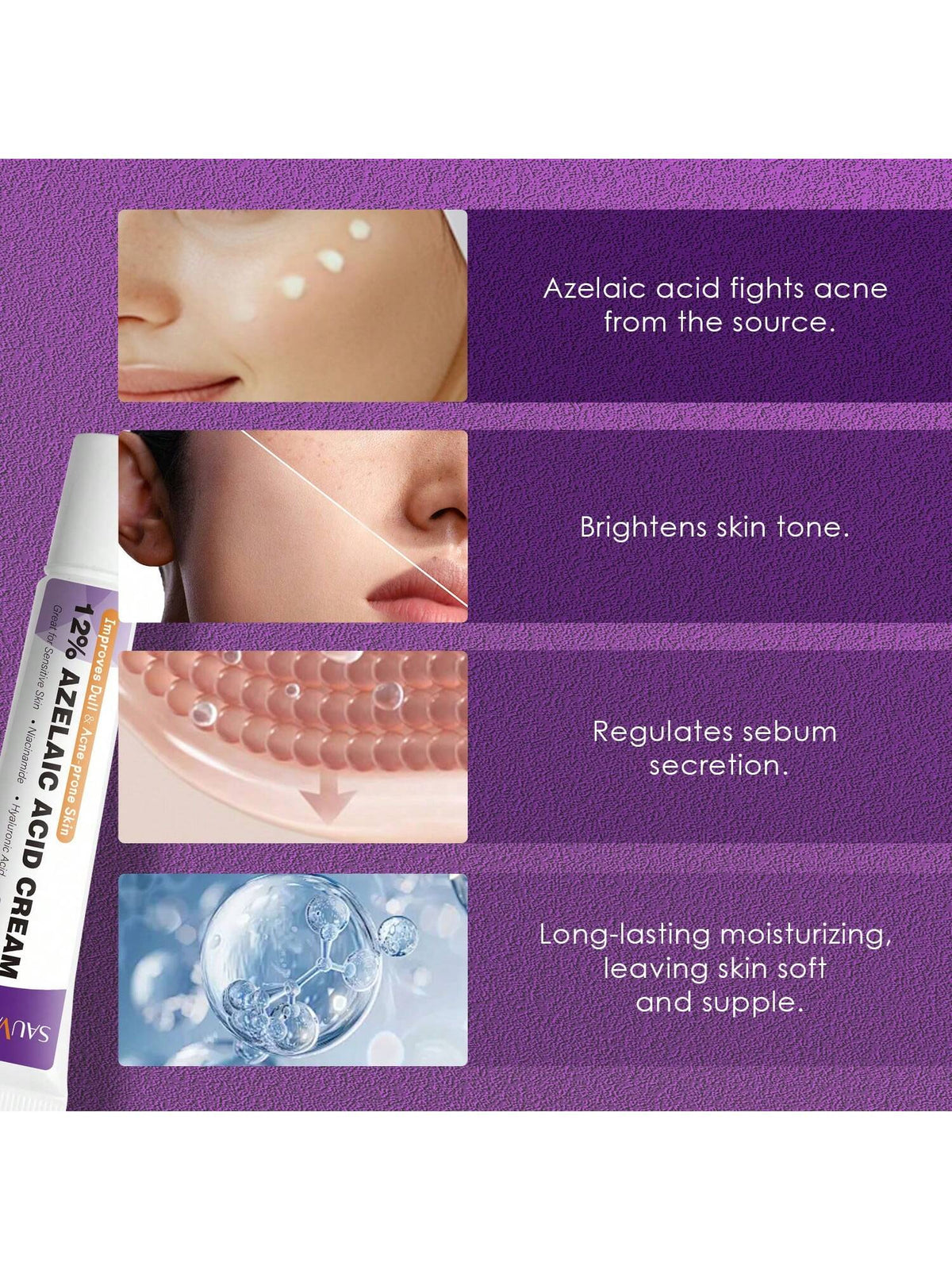 SHEIN Azelaic Acid Cream For Face Acne Cream