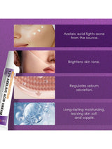 SHEIN Azelaic Acid Cream For Face Acne Cream