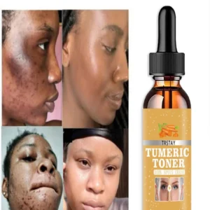 SHEIN 5ML30ML Turmeric Lemon Skin Glow Face Serum Acne Dark Spot Whitening