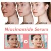 SHEIN Niacinamide Serum Dark Spot Correcting Moisturizing