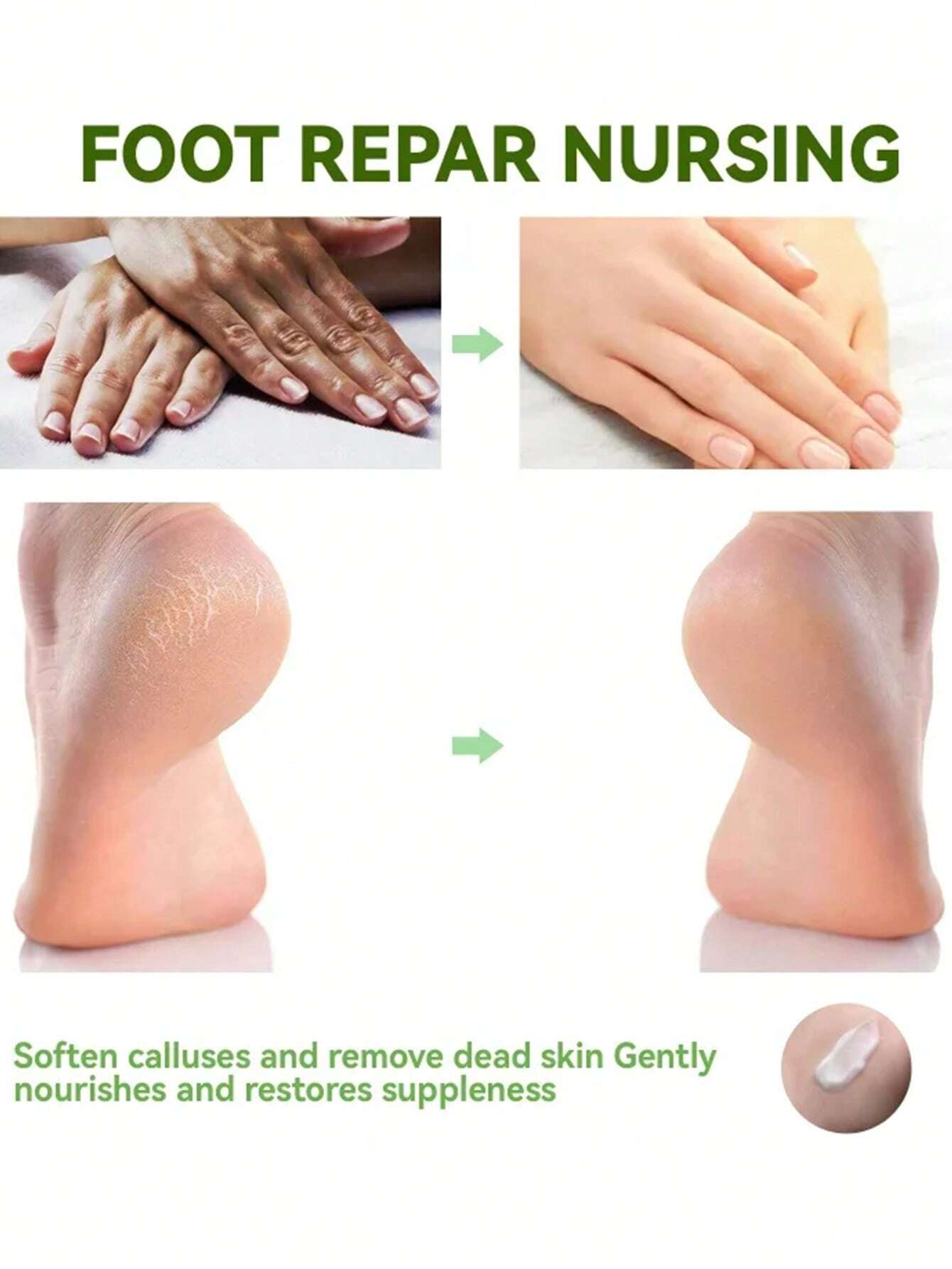 SHEIN Foot Soak Callus Remover Gel Extra Strength Callus