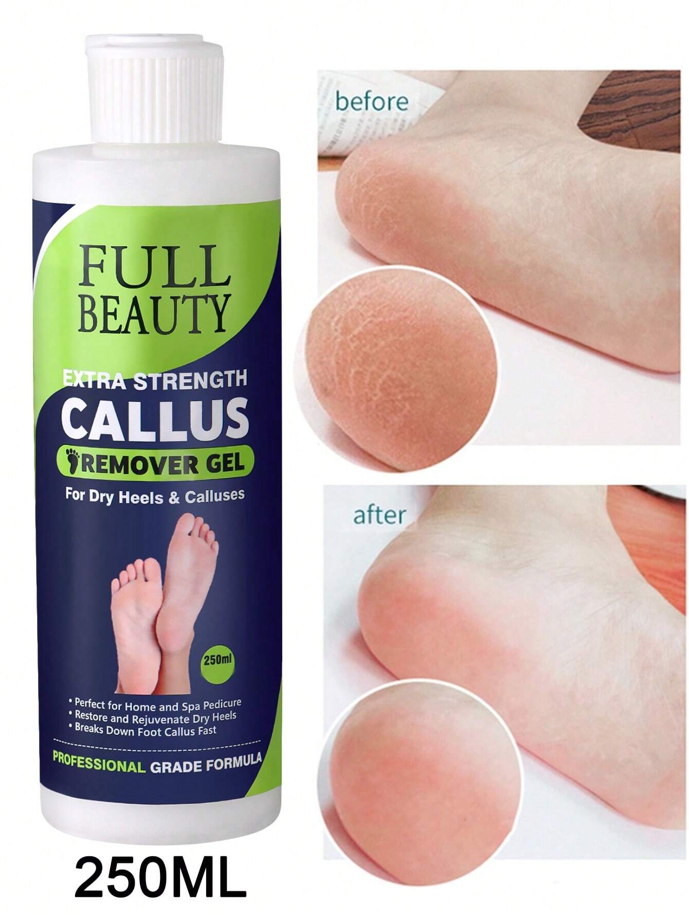 SHEIN Foot Soak Callus Remover Gel Extra Strength Callus