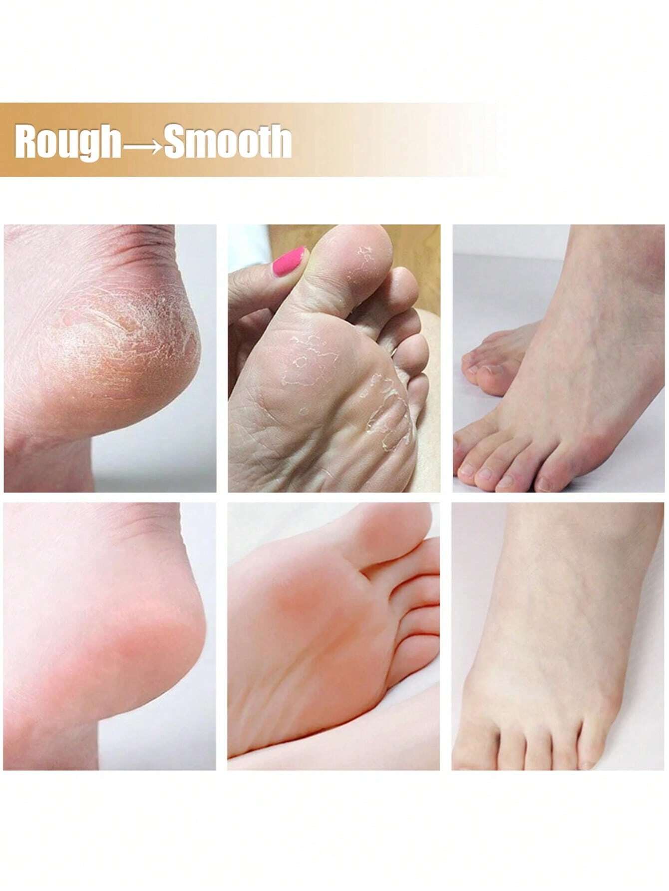 SHEIN Foot Soak Callus Remover Gel Extra Strength Callus