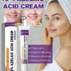 SHEIN Azelaic Acid Cream For Face Acne Cream