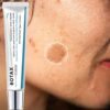 SHEIN Tranexamic Acid Cream, Fades Dark Spots And Brightens Complexion